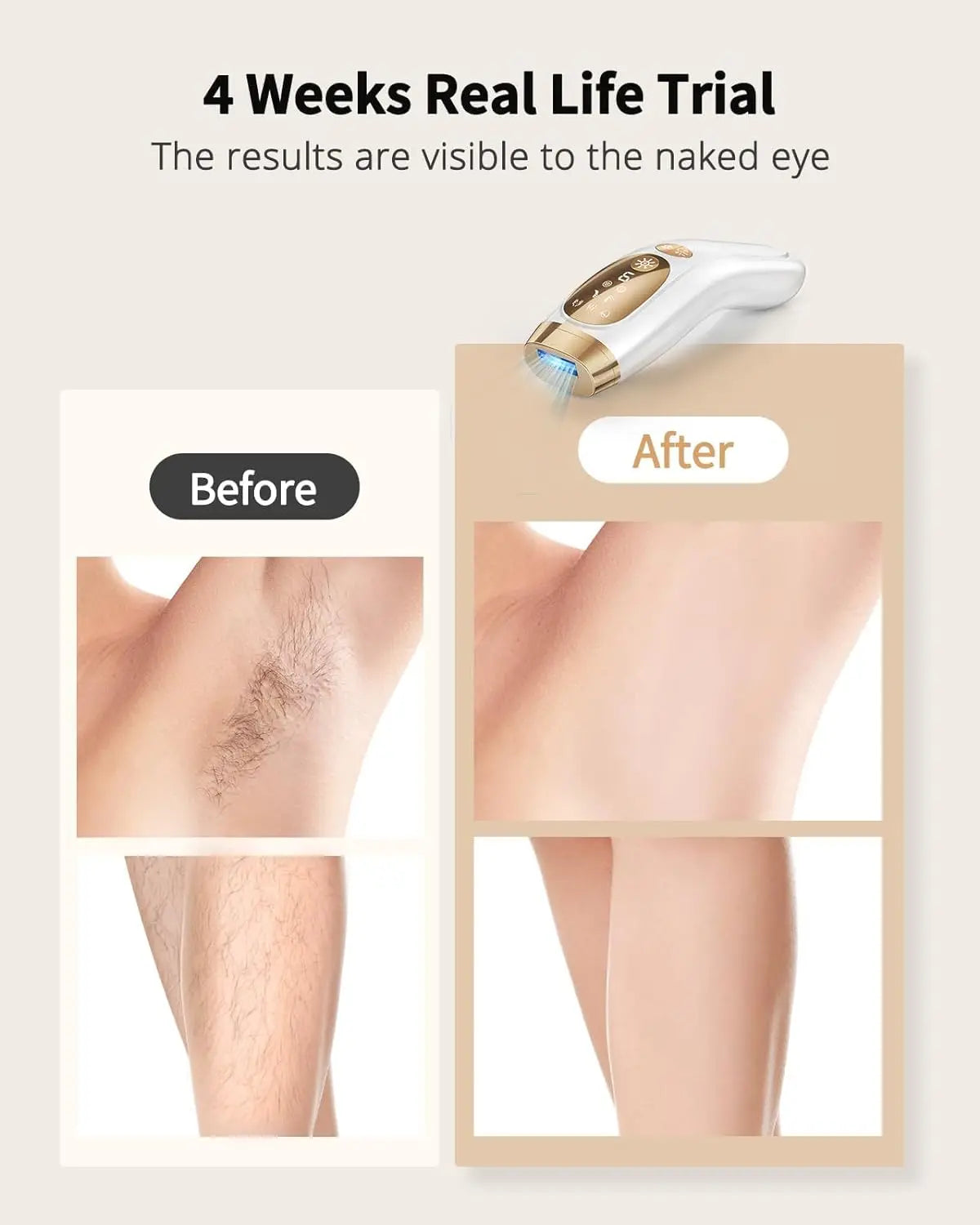 Lysmoski IPL Hair Removal Device With Ice Cooling Unlimited Flashes